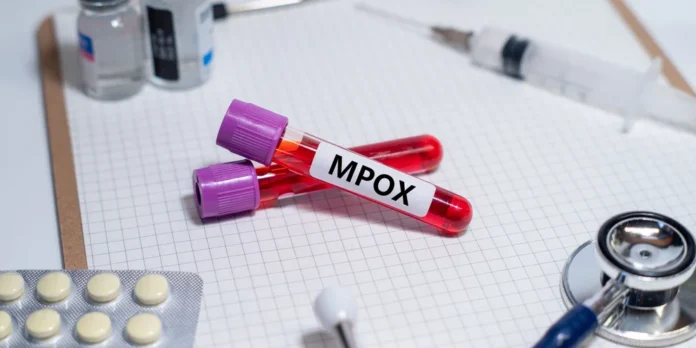 mpox-ios_0.jpg